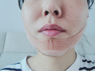 아이디플라코스메틱 아이디 페이스핏 마이너스 밴드 v2 — 5점을 준 리뷰어가 2022년 5월 올린 사용 사진