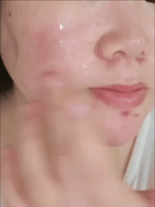나우 [리브엠] 화해 1등 진정 앰플, 엑소코어 카밍 텐션 앰플 — 5점을 준 리뷰어가 2024년 12월 올린 사용 사진