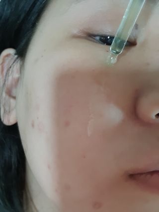 코드네이처 비아미 시카 더블 앰플 — 5점을 준 리뷰어가 2021년 4월 올린 사용 사진
