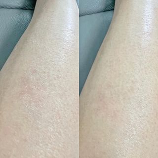 에센느 닥터 센시 아토 프로바이옴 바디로션 — 5점을 준 리뷰어가 2022년 9월 올린 사용 사진
