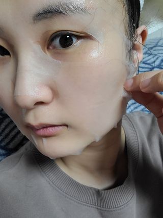 셀몽드 링클 이레이저 스팟 세럼 +핵산 미라클 앰플 마스크 — 5점을 준 리뷰어가 2022년 2월 올린 사용 사진