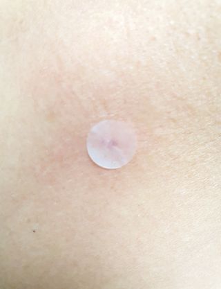 [큐어반H 스팟] 자외선 99프로 차단되는 스틱타입 스팟밴드(1팩 / 66매입) — 5점을 준 리뷰어가 2022년 11월 올린 사용 사진