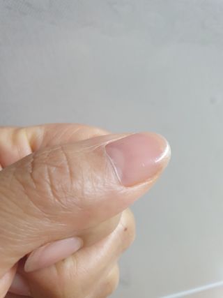 젤리핏 피치리페어 10ml 피치 컬러영양제 효과있는 손톱강화제 — 4점을 준 리뷰어가 2022년 7월 올린 사용 사진