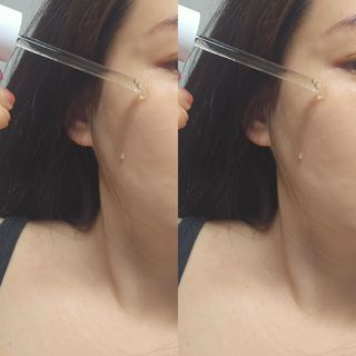 [스킨1004] 마다가스카르 센텔라 앰플 100ml — 5점을 준 리뷰어가 2024년 5월 올린 사용 사진