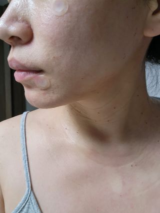 닥터플리너스 제트 큐어 크림 30ml + 제로 트러블 패치 9EA — 3점을 준 리뷰어가 2022년 5월 올린 사용 사진
