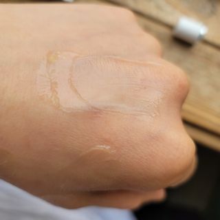 히루스카 포스트아크네 클리어 — 5점을 준 리뷰어가 2021년 2월 올린 사용 사진