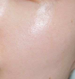 바이오오일 [바이오-오일] 스킨케어 오일 내추럴 60ml — 5점을 준 리뷰어가 2021년 5월 올린 사용 사진