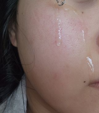 MF[스킨1004] 마다가스카르 센텔라 앰플 100ml — 5점을 준 리뷰어가 2024년 5월 올린 사용 사진