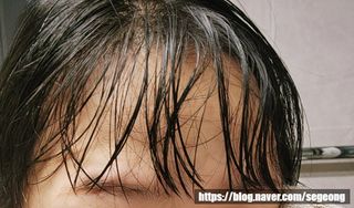 닥터시드 티트리 앤 라임 비건 지성케어 쿨 탈모 샴푸 (1000ml) — 5점을 준 리뷰어가 2023년 7월 올린 사용 사진