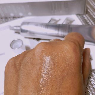 라이브용 [NEW_버진팜스 깨죽크림] 쓱- 바르면 잡티가 사라지는 광/톤/결 비타민크림 — 5점을 준 리뷰어가 2021년 11월 올린 사용 사진