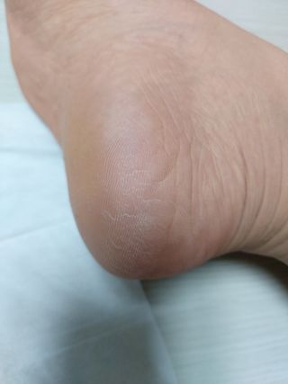 미라클풋 유리발각질제거기 물없이 쓱싹쓱싹 몇번만에 발각질 완벽제거 — 5점을 준 리뷰어가 2021년 8월 올린 사용 사진
