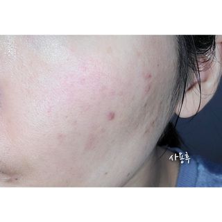 [녹산] 비건 대나무 밸런싱 수분 토너 + 비건 바이오 비타 에센스 — 3점을 준 리뷰어가 2022년 10월 올린 사용 사진