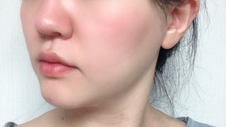 레드투래드 센서티브 어메이징 앰플 30ml — 5점을 준 리뷰어가 2021년 9월 올린 사용 사진