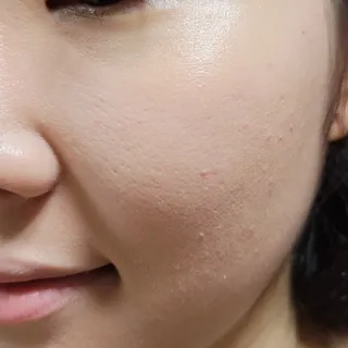 약손명가코스메틱 에오스보떼 블라인드 비비크림 50ml — 5점을 준 리뷰어가 2021년 8월 올린 사용 사진