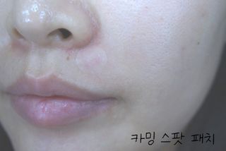 세뚜아(Cettua) 세뚜아 스팟 클리어 듀얼 패치 Cettua Spot Clear Dual Patch — 5점을 준 리뷰어가 2023년 10월 올린 사용 사진