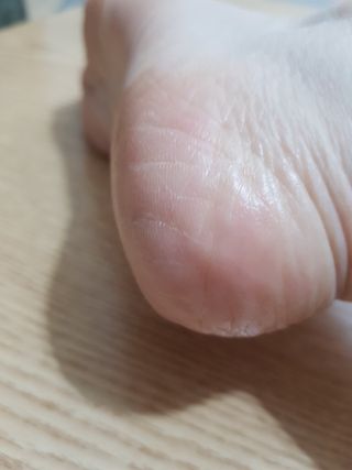 성분에디터 시어버터 아기발스틱 — 5점을 준 리뷰어가 2021년 6월 올린 사용 사진