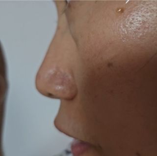 나우 [리브엠] 화해 1등 진정 앰플, 엑소코어 카밍 텐션 앰플 — 5점을 준 리뷰어가 2024년 11월 올린 사용 사진