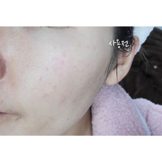 프롬노시베 필앤굿 에센스 마스크 — 3.5점을 준 리뷰어가 2021년 12월 올린 사용 사진