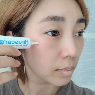 히루스카 포스트아크네 클리어 — 4점을 준 리뷰어가 2021년 2월 올린 사용 사진