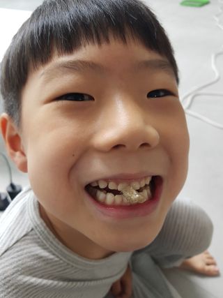 작심연구소 구취제거+충치예방+치아화이트닝 마법의 캔디 덴티팝3종(맛 랜덤 발송) — 5점을 준 리뷰어가 2022년 5월 올린 사용 사진
