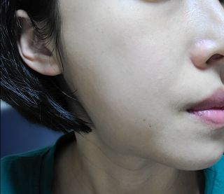 선경코스메디 [NCOSTI] 엔코스티 EGF 펩타이드 리페어 마스크팩 10매입 — 5점을 준 리뷰어가 2022년 3월 올린 사용 사진
