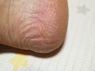 미니러브님이 올린 리뷰 사진 2