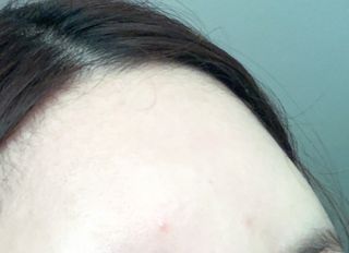 세뚜아(Cettua) 세뚜아 스티키 포어 패치 Cettua Sticky Pore Patch — 5점을 준 리뷰어가 2023년 6월 올린 사용 사진