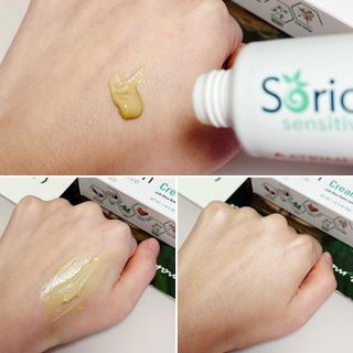 건선/아토/습진/민감성 피부 천연보습진정크림 소리온 크림 & 센시티브 크림 50g — 5점을 준 리뷰어가 2022년 1월 올린 사용 사진