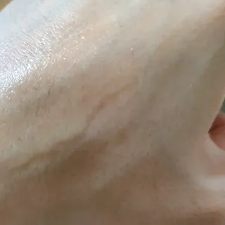 키노닉스 펀더멘탈 앰플 부스터 — 5점을 준 리뷰어가 2021년 10월 올린 사용 사진