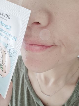 세뚜아(Cettua) 세뚜아 스팟 클리어 듀얼 패치 Cettua Spot Clear Dual Patch — 5점을 준 리뷰어가 2023년 6월 올린 사용 사진