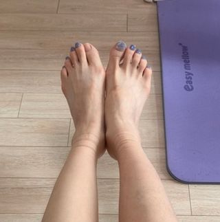 시그바리스 다이나벤 의료용 압박 스타킹 [종아리형] 여름철 다리 붓기 관리 하지정맥류 예방 — 5점을 준 리뷰어가 2024년 8월 올린 사용 사진