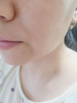 스킨1004 [SKIN1004] 마다가스카르 센텔라 앰플 폼 125ml — 5점을 준 리뷰어가 2024년 8월 올린 사용 사진