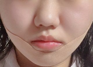아이디플라코스메틱 아이디 페이스핏 마이너스 밴드 v2 — 3.5점을 준 리뷰어가 2021년 6월 올린 사용 사진