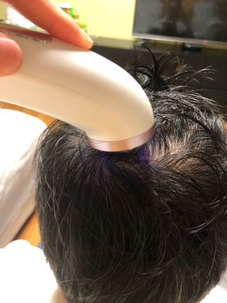 루토닉스 믿쓰박스 볼륨부스터 두피 홈케어 솔루션 — 5점을 준 리뷰어가 2021년 12월 올린 사용 사진