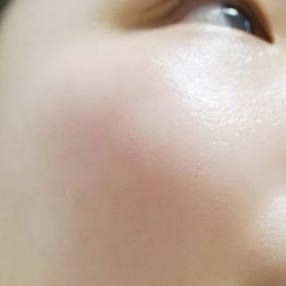더말로지카 슈퍼 리치 리페어 — 5점을 준 리뷰어가 2020년 12월 올린 사용 사진
