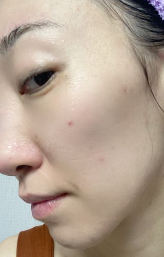 프리 (블로그체험단) [밀리밀리] 메디 앰플 비타 15ml — 5점을 준 리뷰어가 2025년 7월 올린 사용 사진