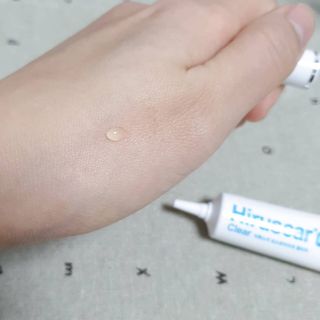 히루스카 포스트아크네 클리어 — 5점을 준 리뷰어가 2021년 1월 올린 사용 사진