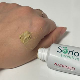건선/아토/습진/민감성 피부 천연보습진정크림 소리온 크림 & 센시티브 크림 50g — 5점을 준 리뷰어가 2022년 1월 올린 사용 사진