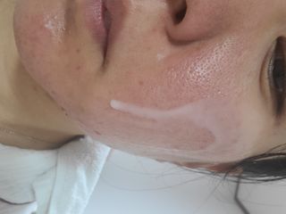 리더스코스메틱 리더스 카밍 바이오틱스 에센스 워터 — 5점을 준 리뷰어가 2021년 12월 올린 사용 사진