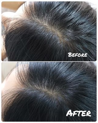 free [아토르] 9종 임상완료 아토르 다름 샴푸바_블랙  프리미엄 두피 케어 샴푸바 — 5점을 준 리뷰어가 2023년 11월 올린 사용 사진