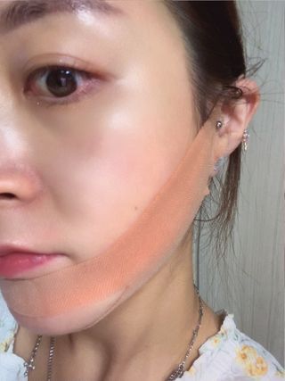 아이디플라코스메틱 아이디 페이스핏 마이너스 밴드 v2 — 5점을 준 리뷰어가 2022년 5월 올린 사용 사진