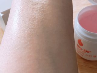 바이오오일 [바이오-오일] 드라이 스킨 젤 100ml — 4.5점을 준 리뷰어가 2021년 6월 올린 사용 사진