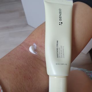 젠바이오 코스메틱스 젠바이오수딩크림]   가려운 피부 & 아토피 원픽 크림 — 5점을 준 리뷰어가 2022년 8월 올린 사용 사진