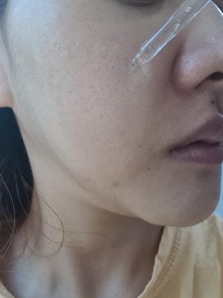 체르엠 스템앤셀 비타민 브라이트닝 에센스 30ml 1개 — 5점을 준 리뷰어가 2021년 9월 올린 사용 사진