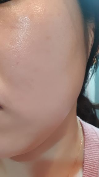 아이디플라코스메틱 아이디 브이로직 플러스 크림 15ml X 4EA — 5점을 준 리뷰어가 2022년 1월 올린 사용 사진