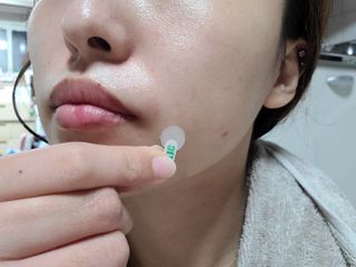 [큐어반H 스팟] 자외선 99프로 차단되는 스틱타입 스팟밴드(1팩 / 66매입) — 5점을 준 리뷰어가 2022년 11월 올린 사용 사진