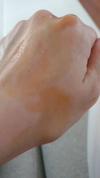 유니베르소 로즈힙 오일 15ml — 5점을 준 리뷰어가 2021년 6월 올린 사용 사진