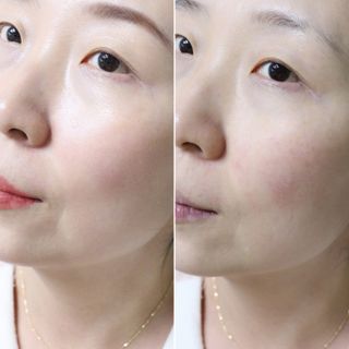 비알티씨 BRTC 시카 바이옴 블랙헤드 클렌징 폼 150ml — 5점을 준 리뷰어가 2022년 12월 올린 사용 사진