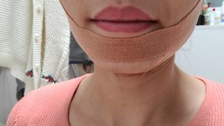 아이디플라코스메틱 아이디 페이스핏 마이너스 밴드 v2 — 5점을 준 리뷰어가 2021년 4월 올린 사용 사진