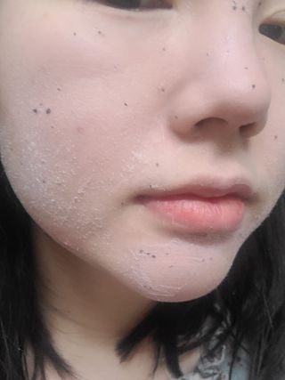 프롬노시베 로지 클레이 버블 팩 — 5점을 준 리뷰어가 2022년 2월 올린 사용 사진